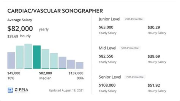 Cardiac Sonographer Salary How Much Does A
