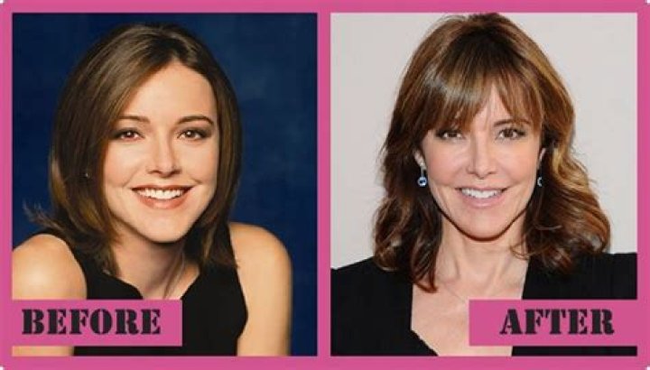 Christa Miller Plastic Surgery Before And After Pics Age And Husband ·