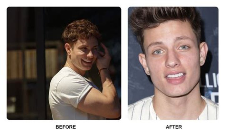 Dive Into The Untold Story Of "Matt Rife Before Dental"