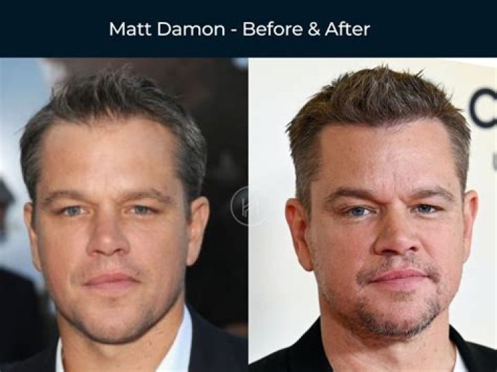 How To Find Celebrity Before And After Transformation Pics