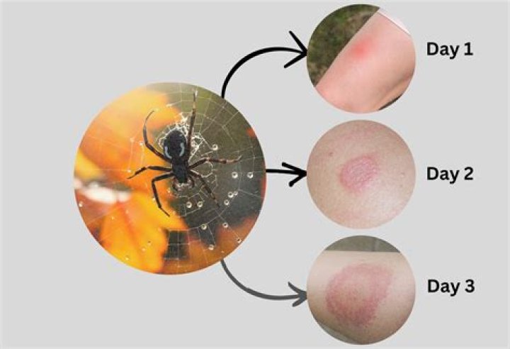 How To Identify And Control Creepy Wall Bugs That Look Like Spiders