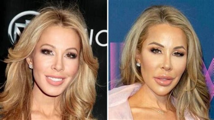 Lisa Hochstein Before And After ·