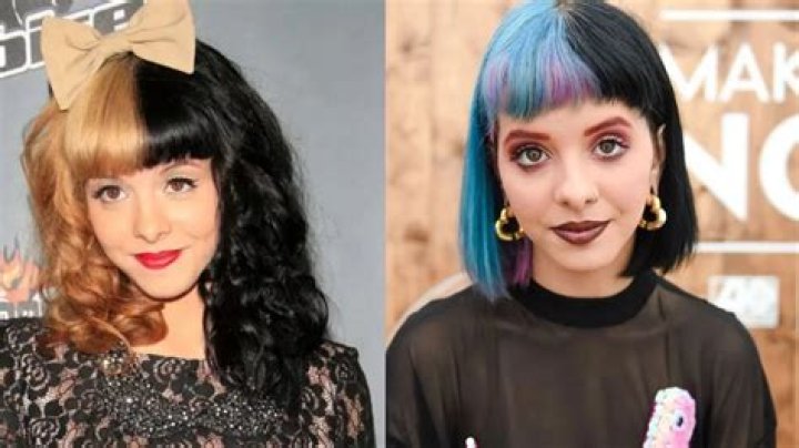 Melanie Martinez's Plastic Surgery Rumors